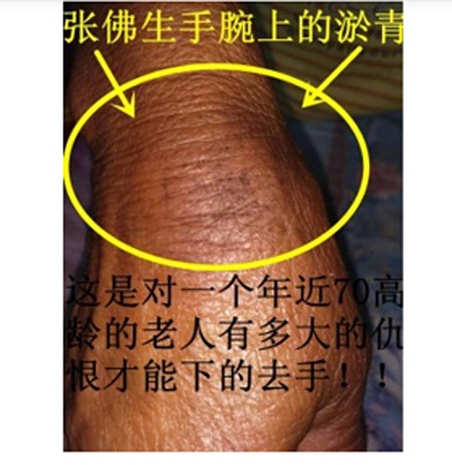 山西懷仁市為修路強征農地 村民阻攔被暴力相向