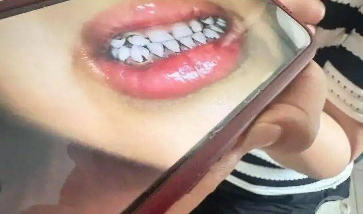 中国甘肃幼儿园铅中毒案 官方宣布提高为省级调查