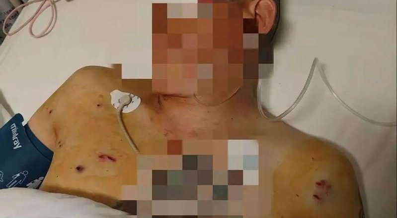 鄭州男提現金百萬遇劫 中彈失明控銀行袖手旁觀