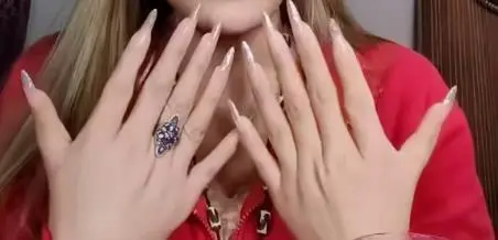 女子天生雙手共12根手指，家中姐弟多人是「六指」，醫生解讀